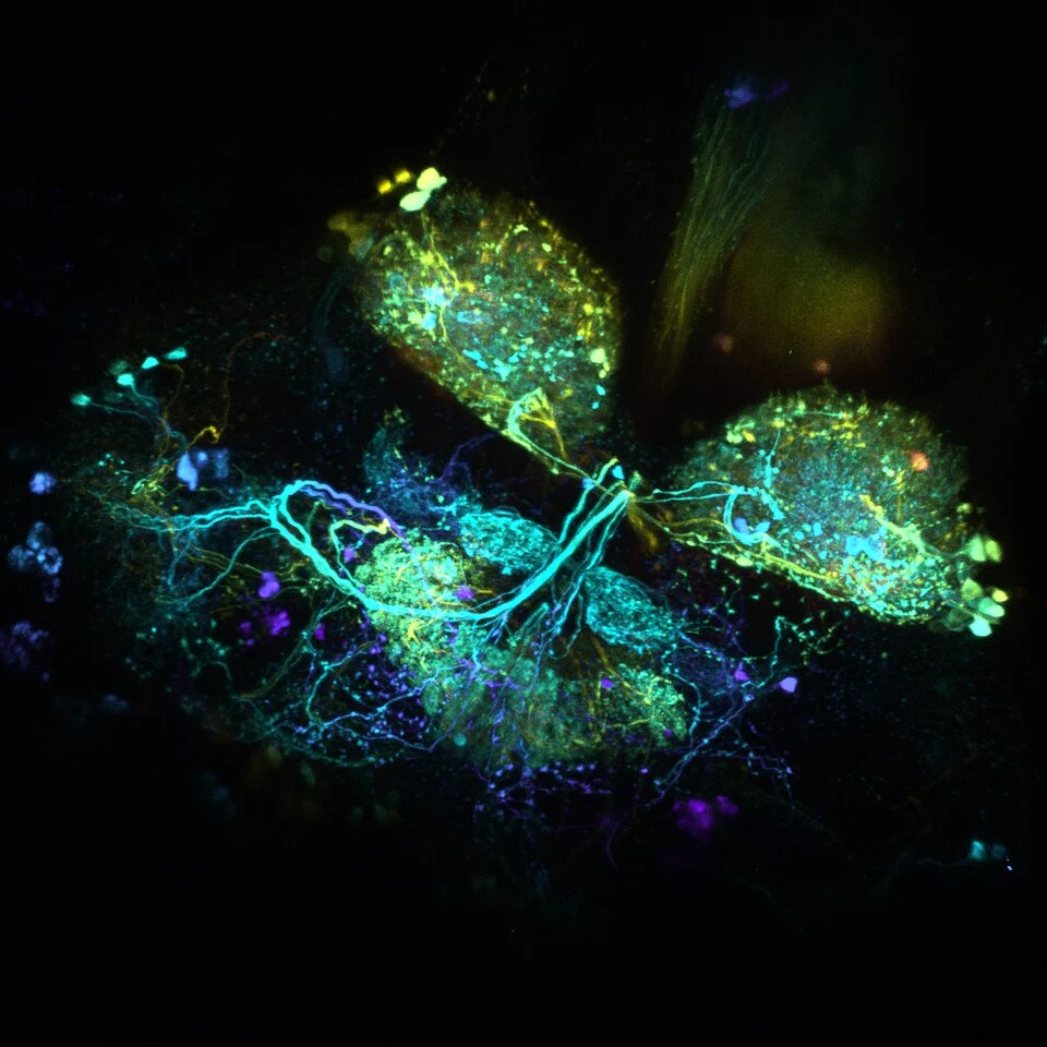 Neuronas marcadas en el cerebro de una mosca de la fruta