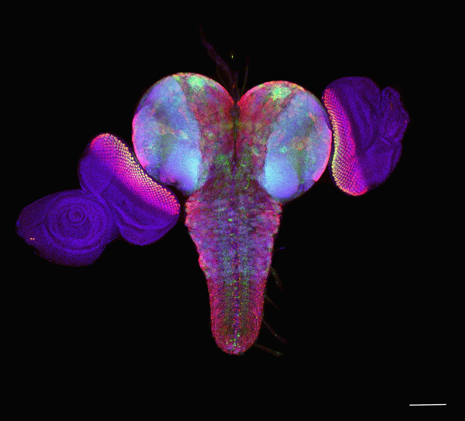 Imagen microscópica del cerebro de una larva de Drosophila